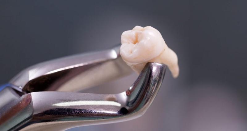 Powikłania po zabiegu stomatologicznym