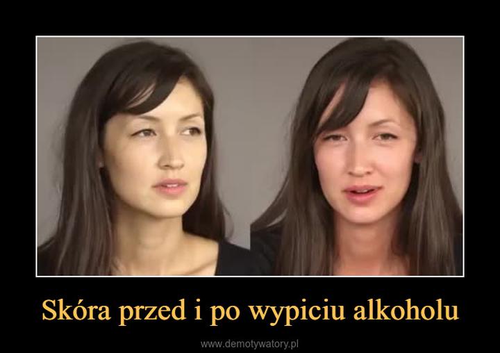 Zdrowie skóry i alkohol