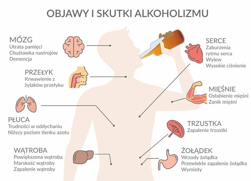 Granica między przyjemnością a problemem